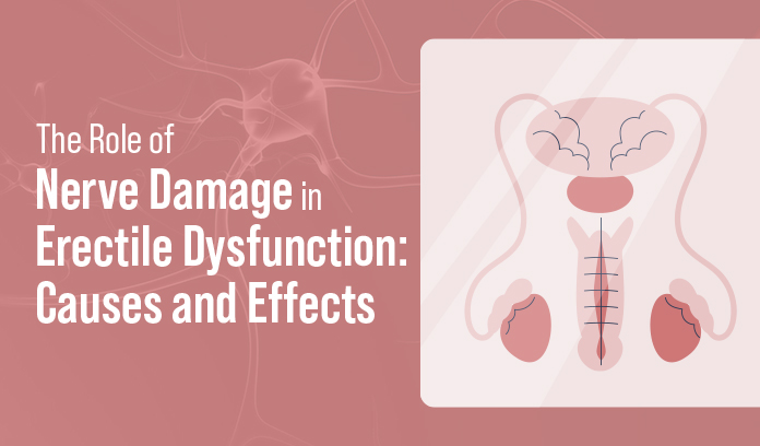 nerve damage in erectile dysfunction
