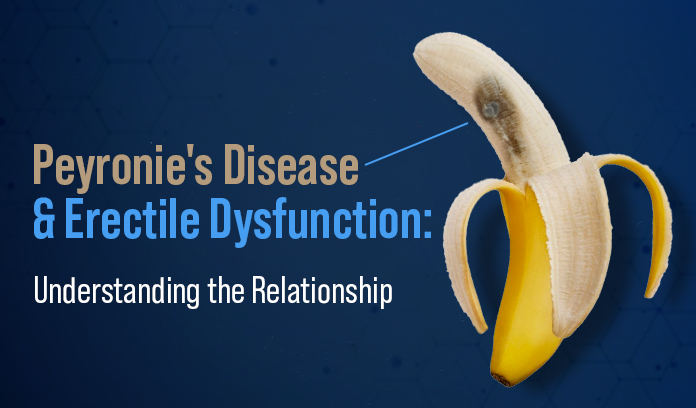 peyronie's disease and erectile dysfunction