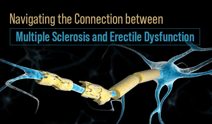 multiple sclerosis and erectile dysfunction