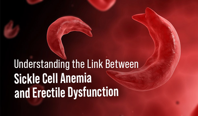 sickle cell anemia and erectile dysfunction